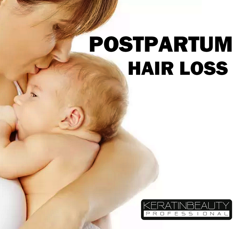 Postpartum hair loss